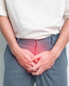 Lantas, varikokel menyebabkan mani encer? Jawabannya, kondisi ini memang dapat memengaruhi kualitas sperma dan cairan semen pada sebagian pria.