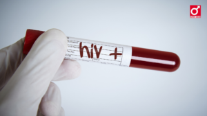 Ilustrasi risiko hiv akibat kencing nanah yang tidak tertangani